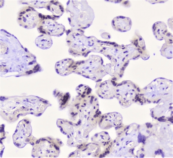 Properdin / CFP Antibody