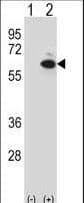 Polyclonal Rabbit anti-Human GOPC / PIST Antibody (aa357-386, IHC, WB)