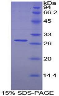 Mouse LILRB3 Protein (Recombinant His-T7)