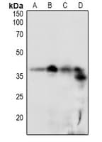 Polyclonal Rabbit anti-Human RCAN1 / DSCR1 Antibody (WB)