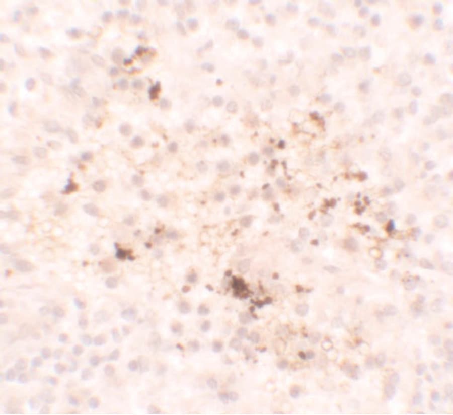 Polyclonal Rabbit anti-Human CCL2 / MCP1 Antibody (IHC, IF, WB)