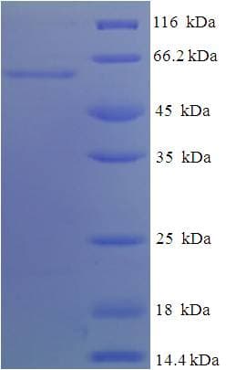 Human APOA4 Protein (Recombinant His-SUMO)