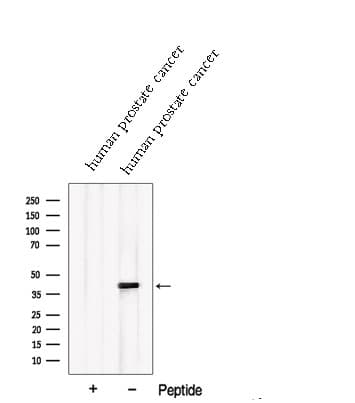 PDGF-D Antibody