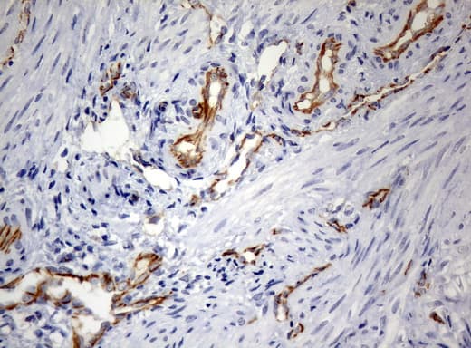 PECAM-1 / CD31 Antibody (clone UMAB32)
