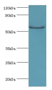 CSTF2 / CstF-64 Antibody (aa1-180)