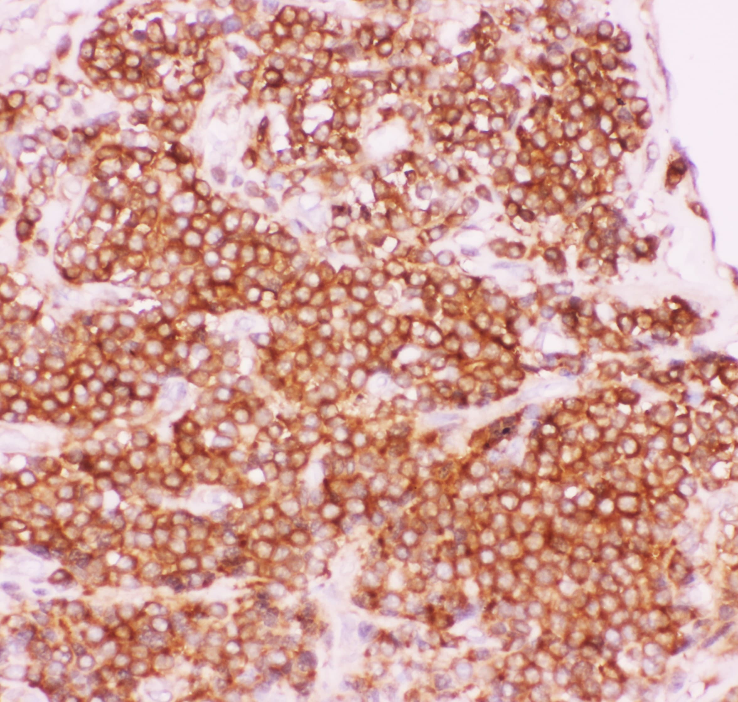 Polyclonal Rabbit anti-Human NFKB1 / NF-Kappa-B Antibody (aa1-360, IHC, WB)