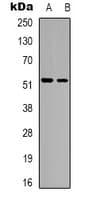 HNF4A / HNF4 Antibody (Internal)