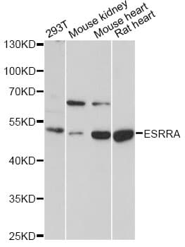 Polyclonal Rabbit anti-Human ESRRA / ERR Alpha Antibody (IHC, WB)
