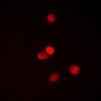 Polyclonal Rabbit anti-Human SNAI1 + SNAI2 Antibody (C-Terminus, IHC, IF, WB)