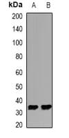 KHK / Ketohexokinase Antibody