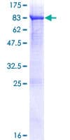 Human FSD1 Protein (Recombinant GST)
