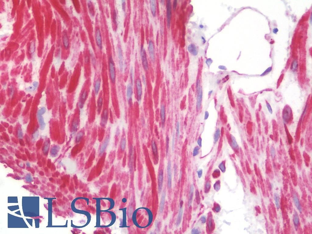 IHC-plus™ DES / Desmin Antibody (Ile448)