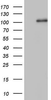 NCAM / CD56 Antibody (aa20-718, clone OTI3H2)