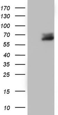 Monoclonal Mouse anti-Human RIPK3 / RIP3 Antibody (clone OTI2F12, aa233-518, IHC, WB)