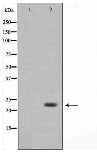 BAK1 / BAK Antibody