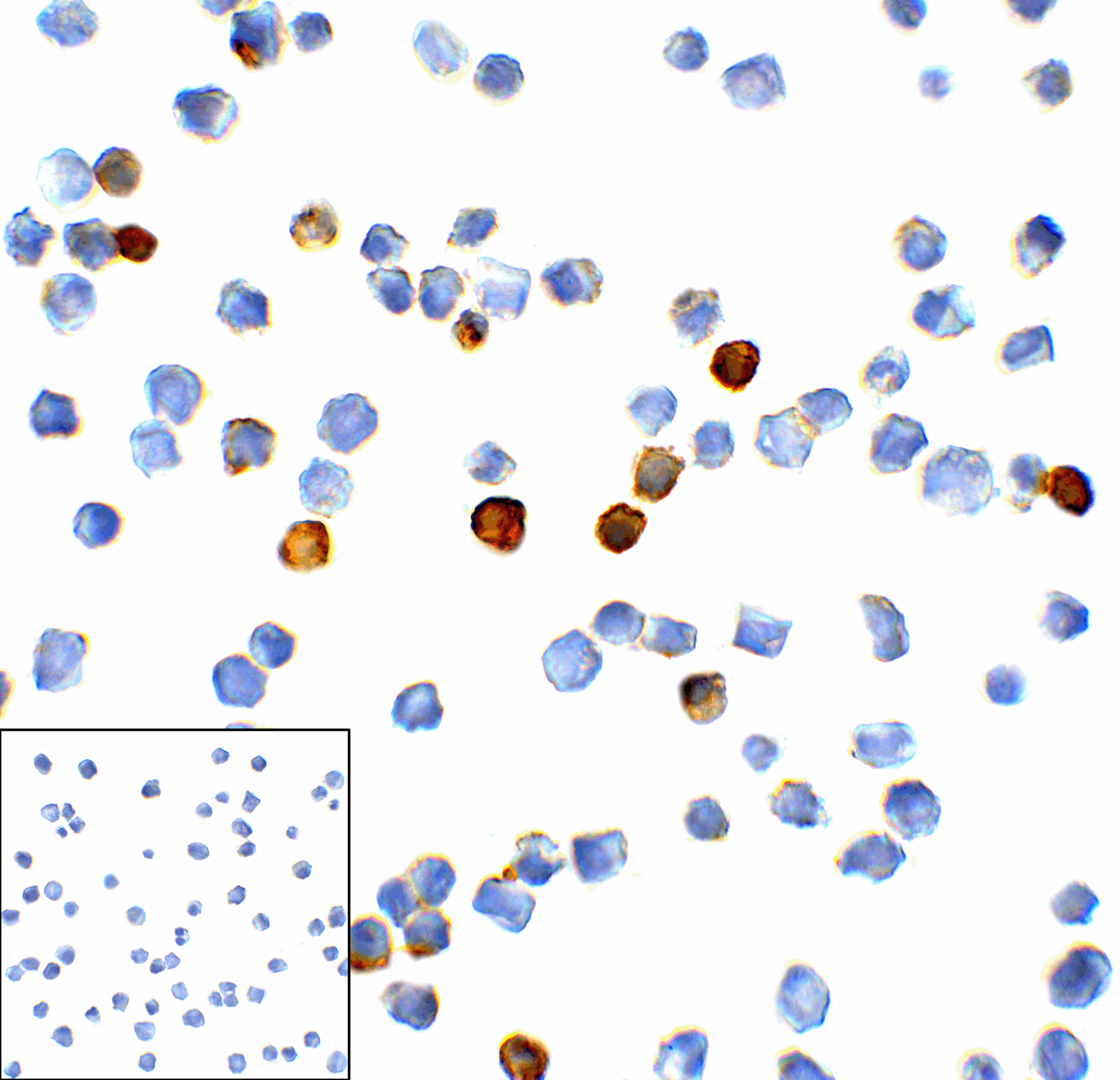 Monoclonal Mouse anti-Human HAVCR2 / TIM-3 Antibody (clone 1B10, IHC, IF, WB)