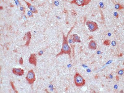 C5AR2 / GPR77 / C5L2 Antibody (clone 1A6)