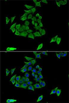 TGM3 / Transglutaminase 3 Antibody