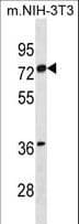Polyclonal Rabbit anti-Human ER Alpha / Estrogen Receptor Antibody (aa130-157, WB)