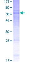 Human CRFR1 / CRHR1 Protein (Recombinant GST)