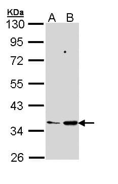 Polyclonal Rabbit anti-Human PTGES2 Antibody (IHC, WB)