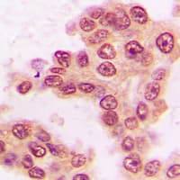 STAT5 A+B Antibody (C-Terminus)