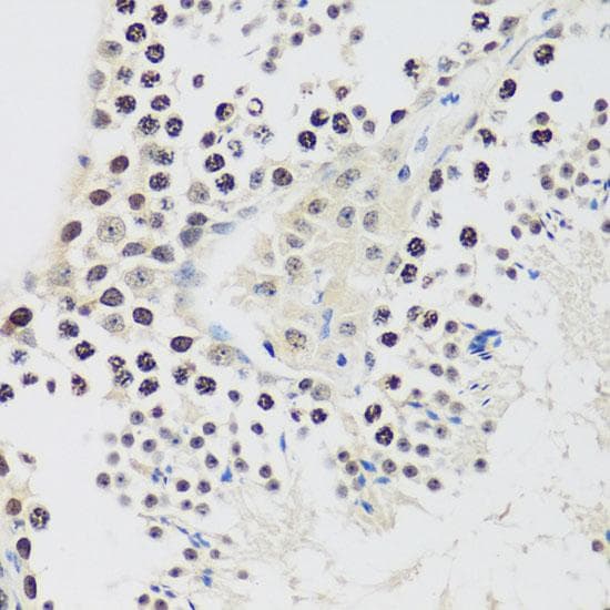 Polyclonal Rabbit anti-Human CCNE2 / Cyclin E2 Antibody (IHC)