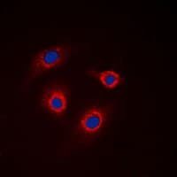 GCNT7 Antibody (C-Terminus)