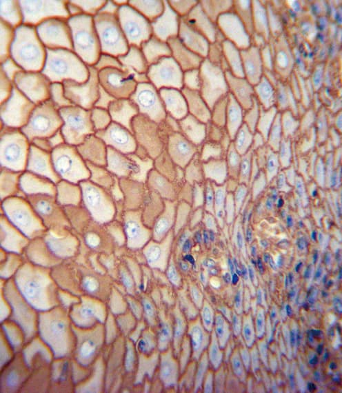 CD44 Antibody (clone Hermes-3)