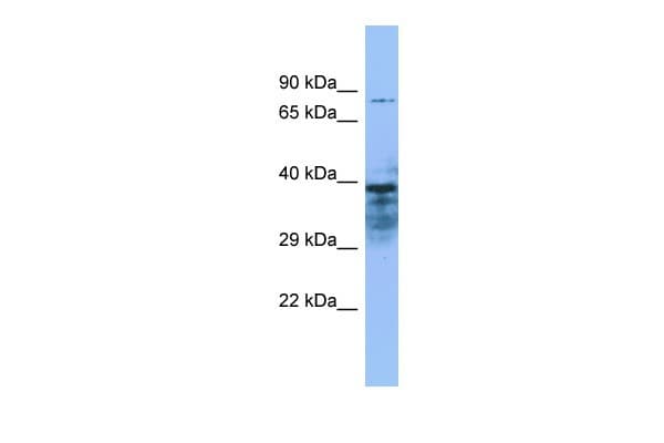 Polyclonal Rabbit anti-Human ZMYND15 Antibody (aa137-186, IHC, WB)