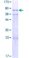 Human CYP-M / CYP20A1 Protein (Recombinant GST)