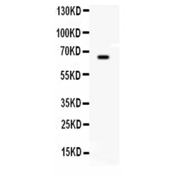 BCHE / Cholinesterase Antibody (aa263-571)