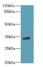 IHC-plus™ VSIR / GI24 / VISTA Antibody (aa37-194)