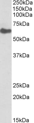IHC-plus™ Polyclonal Goat anti-Human GGT1 / GGT Antibody (aa180-193, IHC, WB)