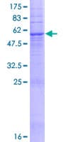 Human TAS2R40 Protein (Recombinant GST)