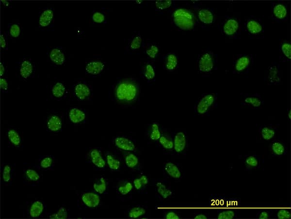 Monoclonal Mouse anti-Human MLH1 Antibody (clone M1, IF, WB)