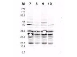 Polyclonal Rabbit anti-Yeast Yeast Rfa2 Antibody (phospho-Ser122, WB)