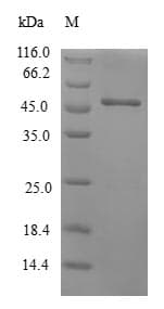 Human CRYGS Protein (Recombinant GST, N-terminus)