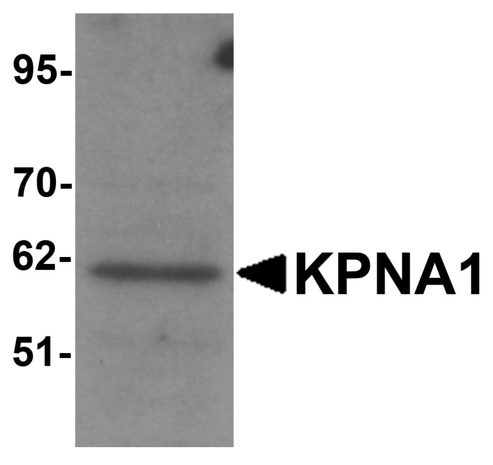 Polyclonal Rabbit anti-Human KPNA1 / Importin Alpha 5 Antibody (IF, WB)