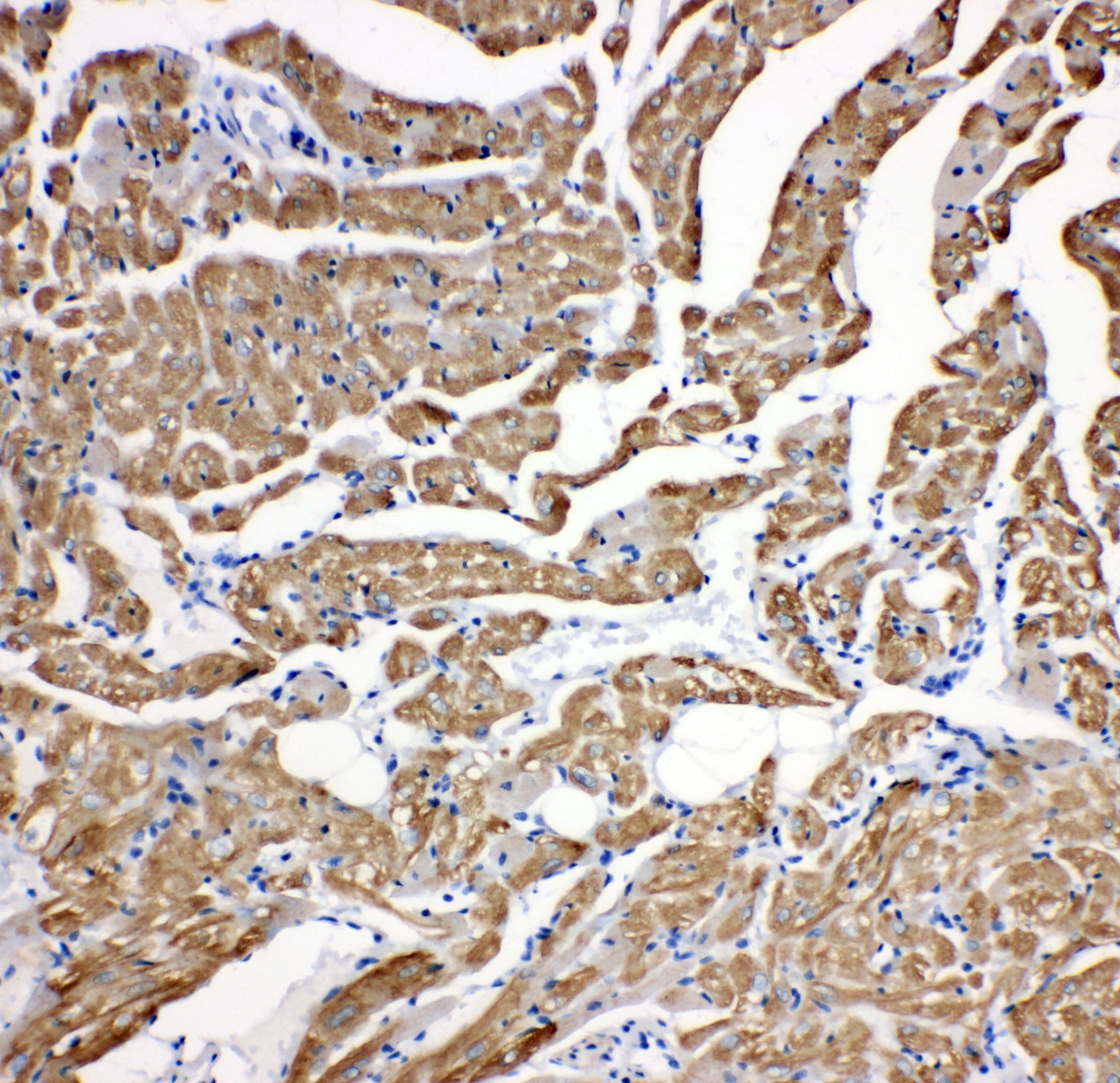 TNNC1 / Cardiac Troponin C Antibody (aa1-18)