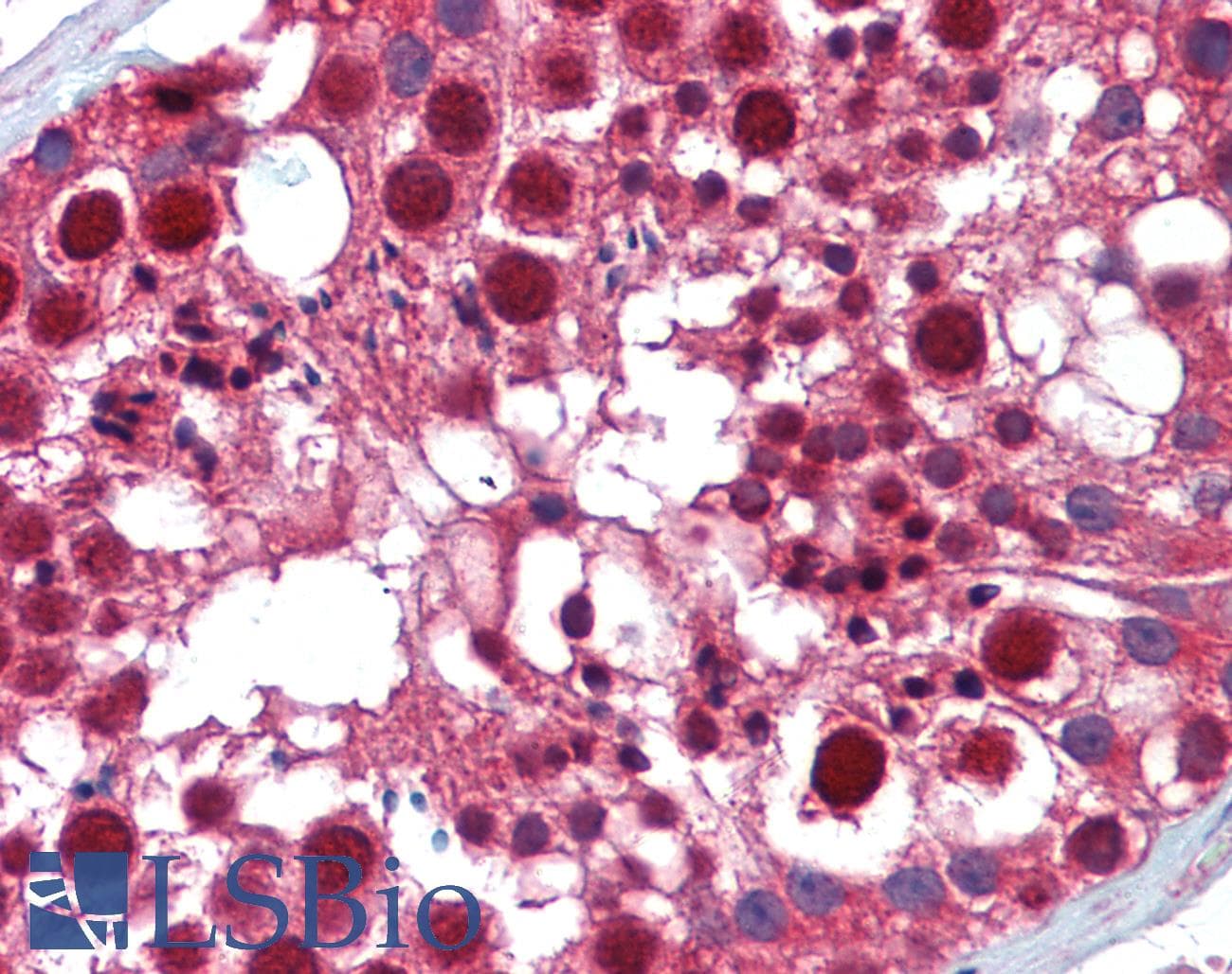 KDM6A / UTX Antibody (C-Terminus)