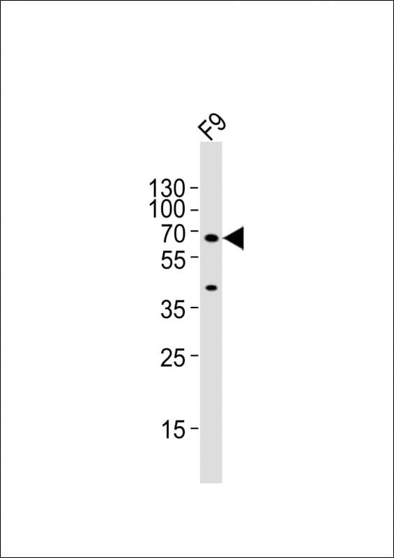 GNL3 / NS / Nucleostemin Antibody (aa420-454)