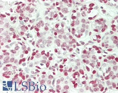 PathPlus™ TFE3 Antibody (Internal)
