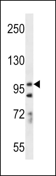 Polyclonal Rabbit anti-Human PCDH7 Antibody (aa1039-1066, IHC, WB)