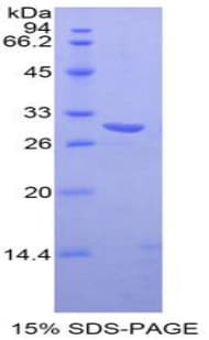 Mouse TXK / RLK Protein (Recombinant His-T7)