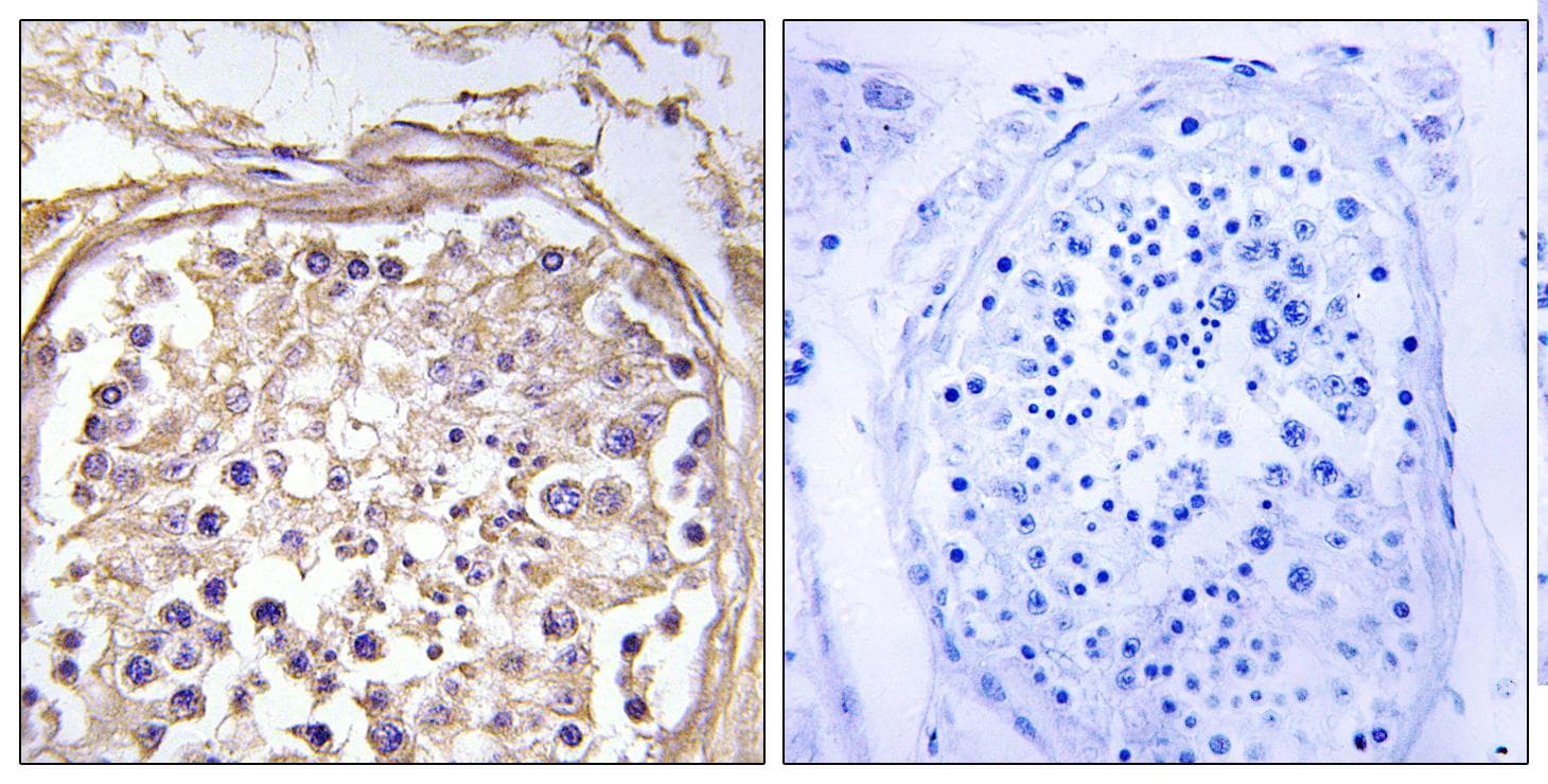 Polyclonal Rabbit anti-Human GALNAC4ST-2 / CHST9 Antibody (IHC, IF)