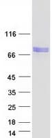 Human PDE12 Protein (Recombinant Myc-DDK (Flag))