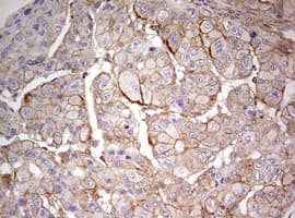 Monoclonal Mouse anti-Human ARFL3 / ARL3 Antibody (clone OTI1C6, aa2-182, IHC, WB)