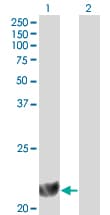DHFR Antibody (clone 2B10)