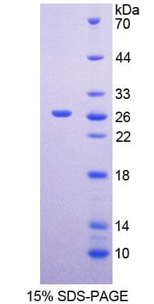 Human MSRA Protein (Recombinant His-T7)